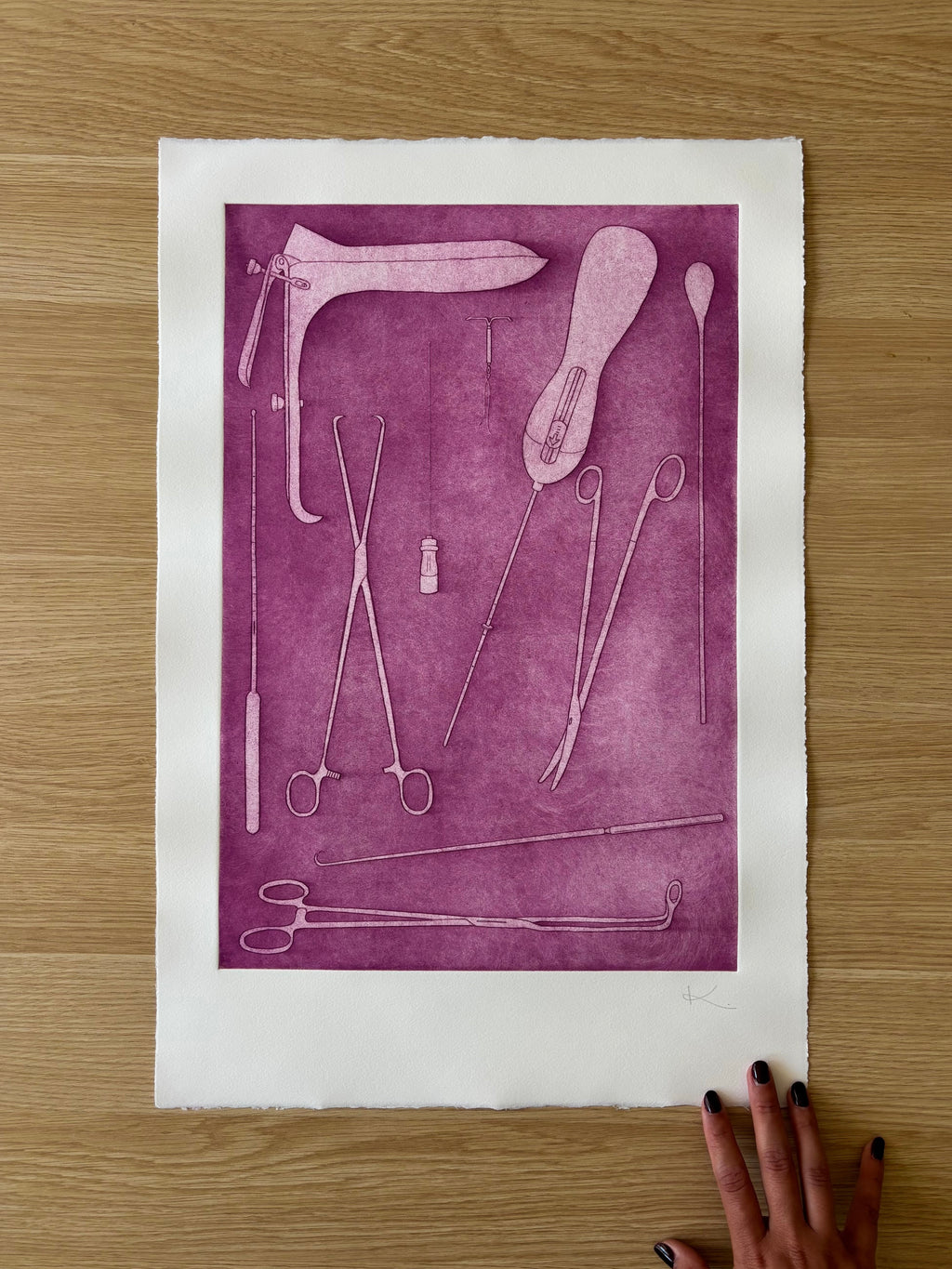 Just Take Ibuprofen — Etching | Fuchsia