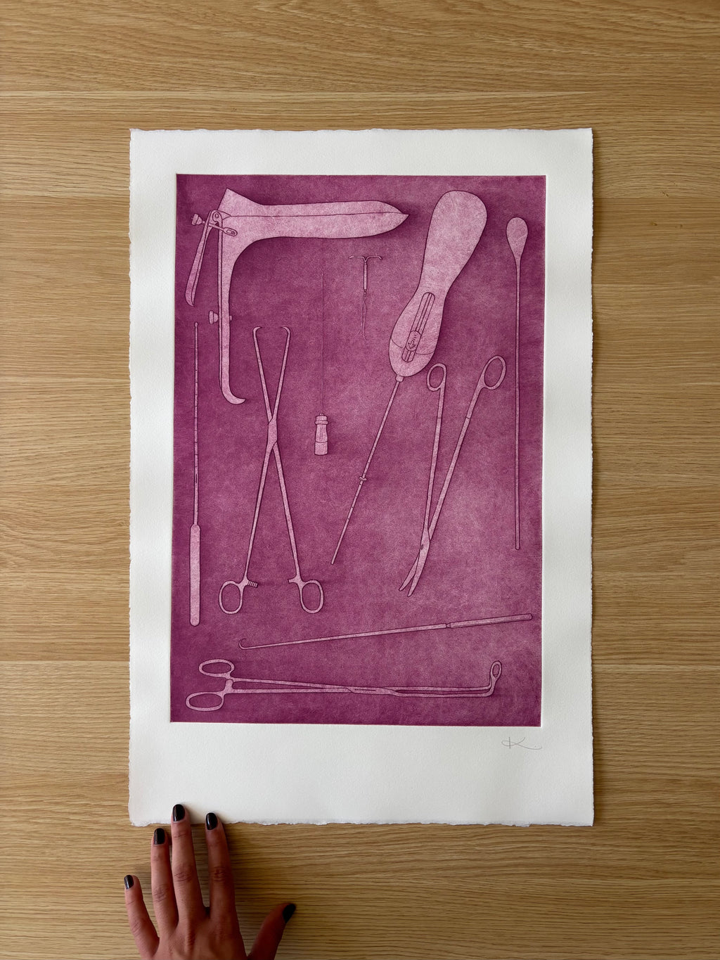 Just Take Ibuprofen — Etching | Berry