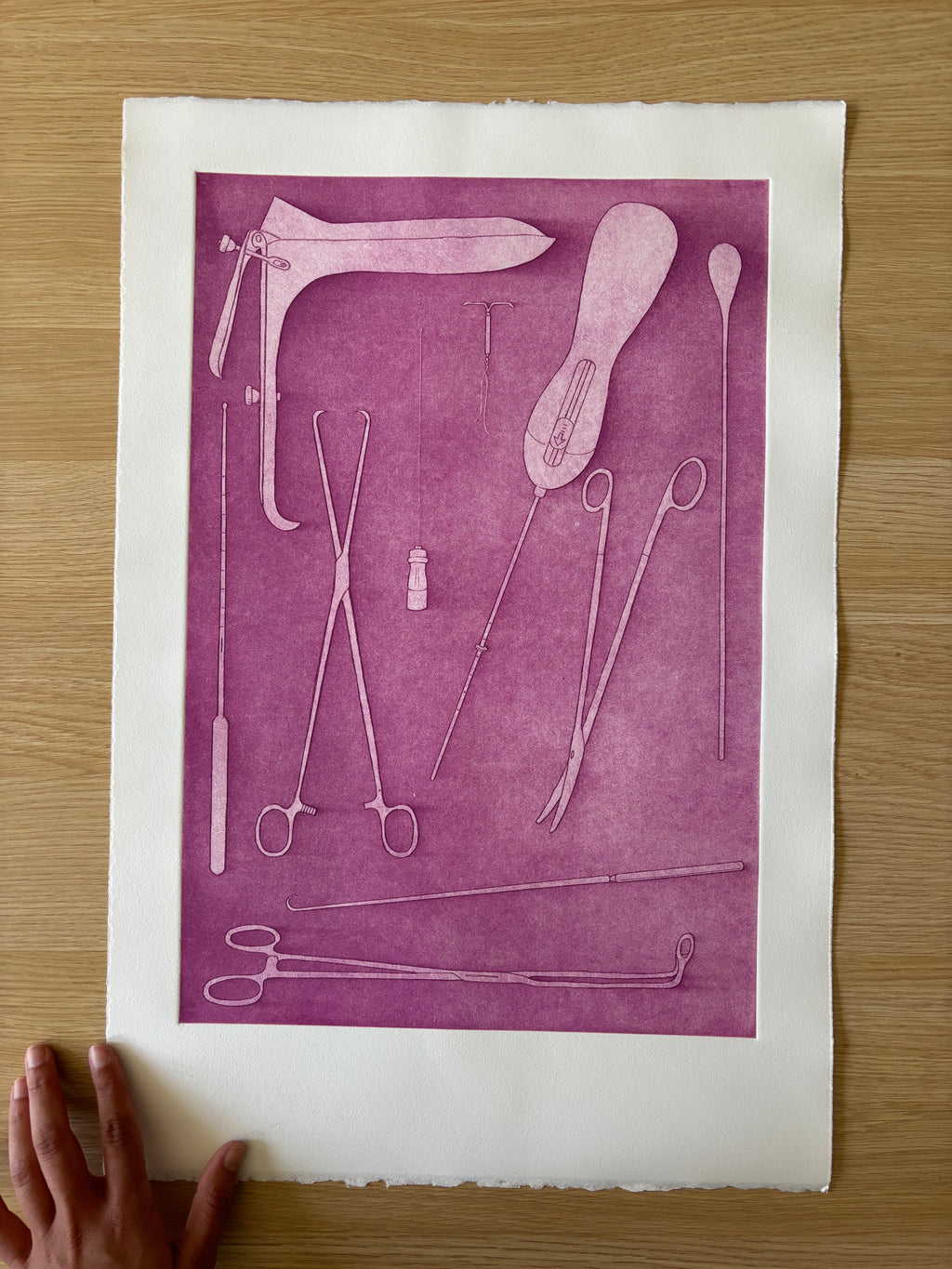 Just Take Ibuprofen — Etching | Fuchsia